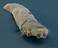 Demodex Mite